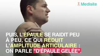 La capsulite de l’épaule peut révéler le diabète de type 2 [upl. by Giacinta]