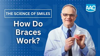 How Do Braces Work [upl. by Ahcrop]