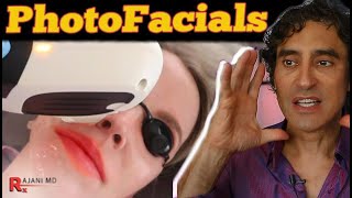 PHOTOFACIAL  HOW MANY IPL TREATMENTS [upl. by Milas]