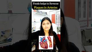 foods to help Reverse Plaques in artery  cholesterol control shorts cholesterol [upl. by Nohsreg878]