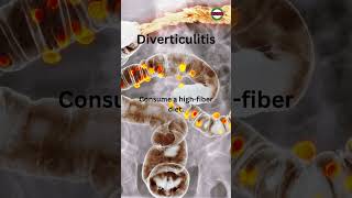 Diet For Diverticulitis [upl. by Biagi980]