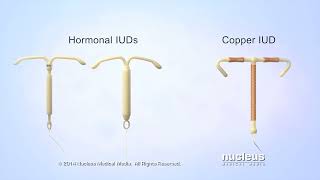 What is an IUD [upl. by Ykcul]