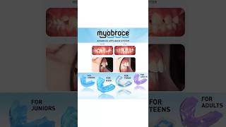 Myobrace Results  Myofunctional Appliances  Holistic Treatment shorts youtubeshorts myobrace [upl. by Cruz]