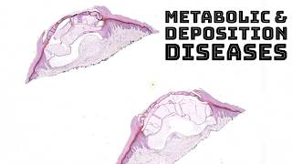 Metabolism amp Deposition Diseases in Skin dermatology dermpath pathology board review [upl. by Anaujal]