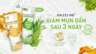 Hazeline  Giảm mụn dần sau 3 ngày  Dòng sản phẩm cho da dầu mụn và da nhạy cảm [upl. by Nancey]