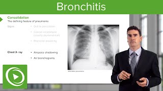 Bronchitis Consequences Symptoms amp Treatment – Respiratory Medicine  Lecturio [upl. by Verlie]