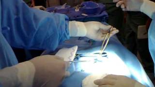 APPENDECTOMY part 1 instrument setup class [upl. by Itsirk]