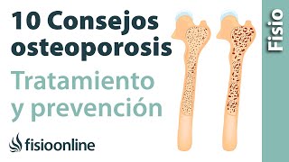 10 consejos para el tratamiento y prevención de la osteoporosis o pérdida de hueso [upl. by Hepsiba]