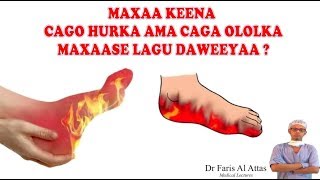 MAXAA KEENA CAGO HURKA AMA CAGA OLOLKA MAXAASE LAGU DAWEEYAA Dr faris [upl. by Rabaj]