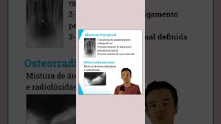 Osteíte Condensante  Características Clínicas e Radiográficas  Resumo Concurso Odontologia [upl. by Stormi702]