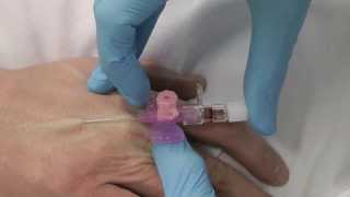 Cannulation How to gain IV access [upl. by Anaahs484]