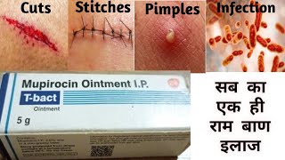 Mupirocin ointment  T bact ointment  mupirocin ointment ip uses in hindi l t bact cream [upl. by Courtney543]