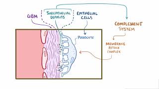 Membranous Glomerulonephritis  Renal Pathology  Osmosis [upl. by Bili]