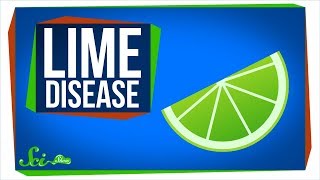 Lime Disease How a Fruity Drink Can Give You a Rash [upl. by Yerac218]