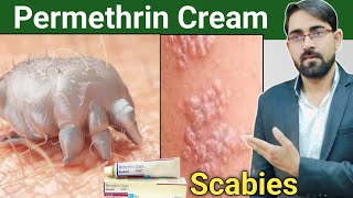 permethrin cream uses in hindi  scabies treatment in hindi  scabies permethrin cream Drx Rabbani [upl. by Latsyrhc]