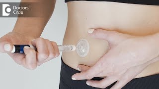 Tips for injecting Insulin  Dr Anantharaman Ramakrishnan [upl. by Catlee]