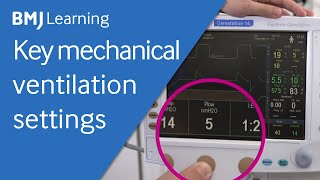 Key settings for a mechanical ventilator  BMJ Learning [upl. by Somisareg]