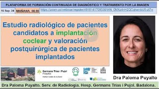 671 Estudio radiológico de pacientes candidatos a implantación coclear [upl. by Anelad]