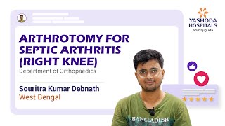 Arthrotomy for Septic Arthritis Right Knee Yashoda Hospitals Hyderabad [upl. by Heida750]