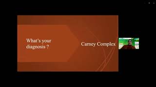 Carney complex A case presentation [upl. by Annav]