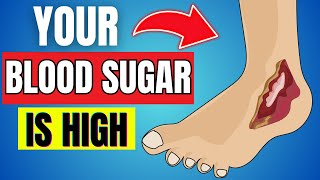 10 ALARMING Signs Your Blood Sugar Is HIGH [upl. by Hurff]