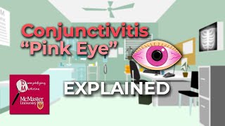 Conjunctivitis Pink Eye Explained [upl. by Leseil]