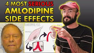 4 Most SERIOUS Amlodipine Side Effects [upl. by Aicats]