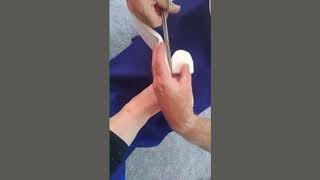 Instruction for use of 7mm Felt Chiropody Padding [upl. by Eiten]