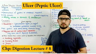 Ulcer Disease peptic ulcer  Causes symptoms and Treatments [upl. by Alletsyrc]