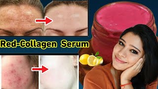 Collagen Serum To Get Youthful GlowingClean amp Clear SkinCollagen For SkinGarima Singh [upl. by Mukund]