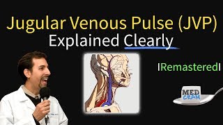 Jugular Venous Pulse JVP  Waveforms amp Evaluation for JVD [upl. by Aihsas]