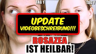 Rosazea HEILMITTEL gefunden SIEHE VIDEOBESCHREIBUNG NICHT Soolantra  NICHT Retinol »Lalalunia« [upl. by Joelle986]