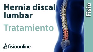 Hernia discal lumbar  Tratamiento con ejercicios automasajes y estiramientos [upl. by Karlow]