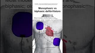 Monophasic vs biphasic defibrillators [upl. by Lavro]