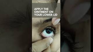 HOW TO APPLY EYE OINTMENT PROPERLY  NEW VISION EYE HOSPITAL MUNDAKAYAMPOONJAR [upl. by Irv]