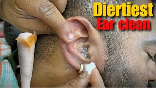 Dirtiest Ear Cleaning amp Ear Wax removal Head Massage by  Shamboo Barber  Asmr Ear Cleansing [upl. by Ramu]