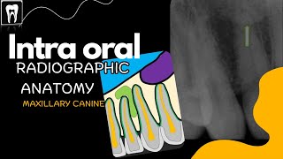 Normal radiographic anatomical landmarks  Intra Oral Anatomy  Maxilla Canine [upl. by Atsirc]