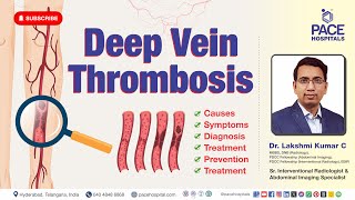 Deep Vein Thrombosis DVT  Causes Symptoms Risk Factors Diagnosis Prevention And Treatment [upl. by Malvino]