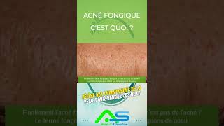 acne fongique c est quoi [upl. by Townshend]