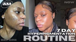 HOW I CLEARED MY HYPERPIGMENTATION amp DARK MARKS IN A WEEK MORNING ROUTINE [upl. by Giess676]