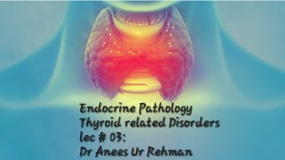 Goiter concept robbinsbasicpathology urdu thyroid [upl. by Schaefer]