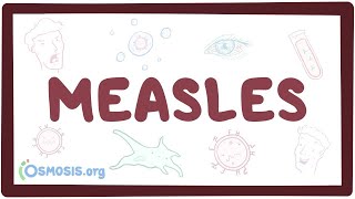 Measles  causes symptoms diagnosis treatment pathology [upl. by Herzen995]