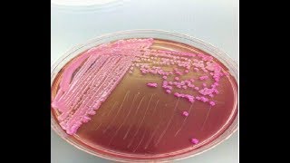 Klebsiella 2 S2650 Microbiology MCQs [upl. by Priscilla]