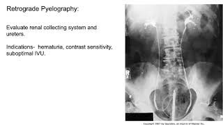 Radiology of the Urogenital system [upl. by Lesser]