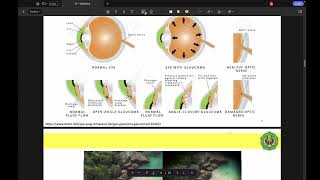 FARMAKOTERAPI  GLAUKOMA [upl. by Kirkwood]
