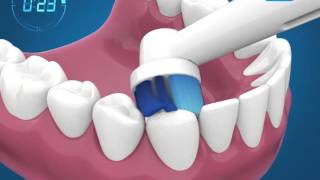 Como escovar os dentes com a escova de dentes elétrica [upl. by Robby]