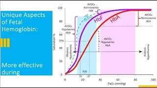 Precision Medicine Approach to Management of PPHN [upl. by Millian246]