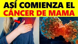 Síntomas Iniciales de Cáncer de Mama que Casi Nadie Nota ¡Reconoce Antes de que Sea Demasiado Tarde [upl. by Jacquenette]