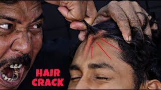 Unlimited Hair Cracking by Asim Barber  Head massage amp Neck Cracking  Loud Spine Cracking  ASMR [upl. by Nylinnej]