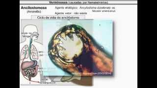 Verminoses causadas por nematelmintos [upl. by Mears]